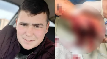 Aksaray’da 20 yaşındaki Gencin Ateşlediği havai fişek elinde patladı