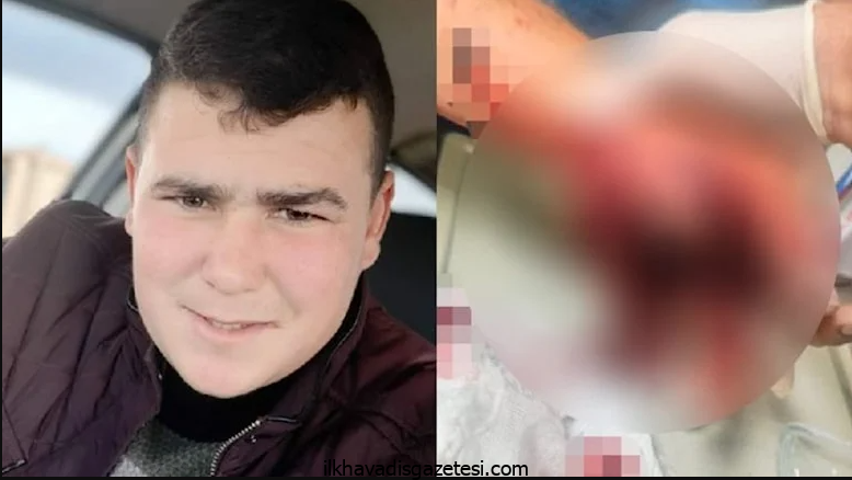 Aksaray’da 20 yaşındaki Gencin Ateşlediği havai fişek elinde patladı